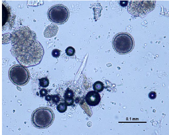 TOXOCARA VITULORUM Oeuf plus ou moins rond Taille standard Paroi épaisse, irrégulière, alvéolée Contenu coloré, une cellule