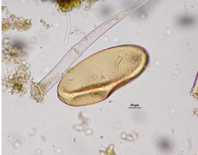 FASCIOLA HEPATICA Oeuf de grande taile : 2TS Jaune paille Ballon de rugby dégonflé (Operculé) Paroi lisse