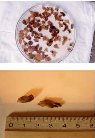 FASCIOLA HEPATICA 3-5cm de long sur 1cm de large Lancéolé brun-grisâtre Epines