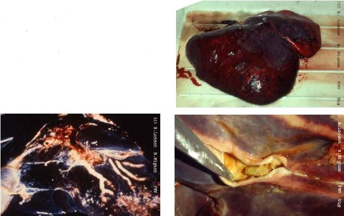 FASCIOLA HEPATICA Adultes : dans les canaux biliaires Larves : dans le parenchyme hépatique Lésions : - hépatite hémorragique - hyperplas...