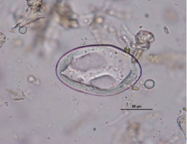 PARAMPHISTOMUM SP. Oeuf de grande taille : 2TS Ballon de rugby dégonflé Translucide