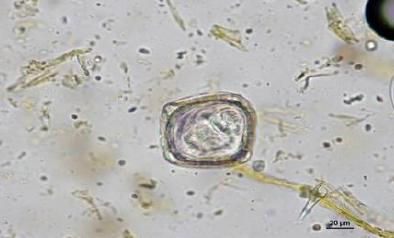 MONIEZIA SP. Oeuf : 55-90µm Quadrangulaire Coque épaisse, lisse Contient un embryon hexacanthe + appareil piriforme