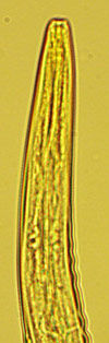 OSTERTAGIA OSTERTAGI 1cm maximum Brun-rougeâtre Capsule buccale très réduite Striations longitudinales