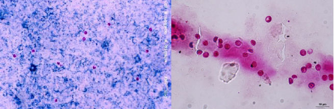 CRYPTOSPORIDIUM PARVUM Cercles rouges-roses vifs sur fond bleu clair