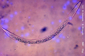 DICTYOCAULUS VIVIPARUS 300-400µm Tête arrondie, pas de bouton céphalique Oesophage simple non rhabditiforme Granulation Extrémité caudale...