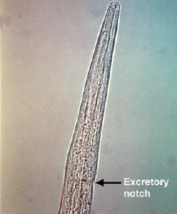 TRICHOSTRONGYLUS AXEI Très petit : <7mm Dépression cuticulaire oesophagienne