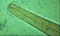 COOPERIA ONCOPHORA 1-2cm de long Dilatation céphalique légère Striations oesphagiennes