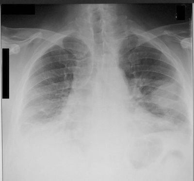Image for question 18
