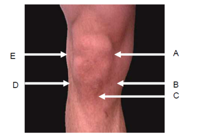 Image for question 7