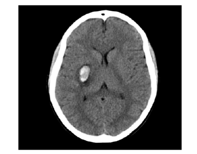 Image for question 9