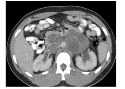 Image for question 34