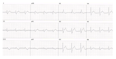 Image for question 61