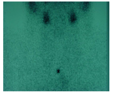 Image for question 69