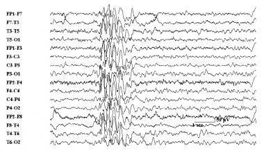 Image for question 5