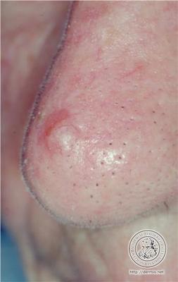 Image for question 5