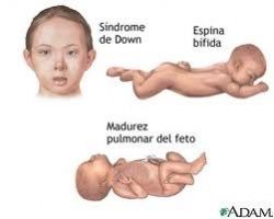 Descomposición De la Personalidad Psíquica-Freud.