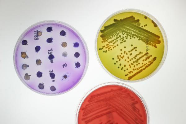 Técnicas de cultivo bacteriano y obtención de cultivos puros