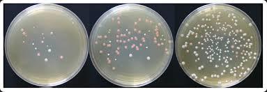 Técnicas de cultivo bacteriano y obtención de cultivos puros