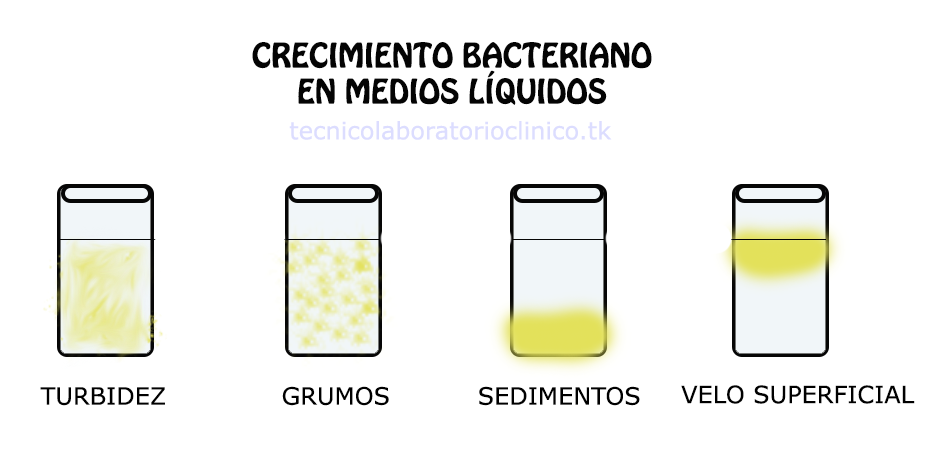 Siembra Y Cultivos Puros