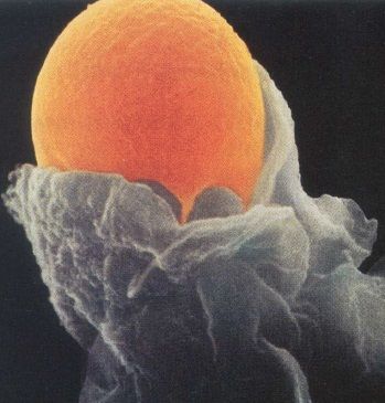 Membrana plasmática y sistema endomembranal