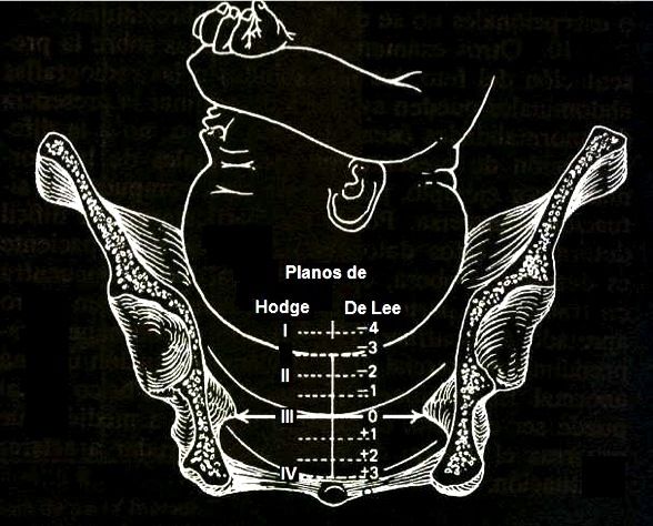 Pelvis osea, presentación, actitud y situación fetal. Evolución fetal anteparto