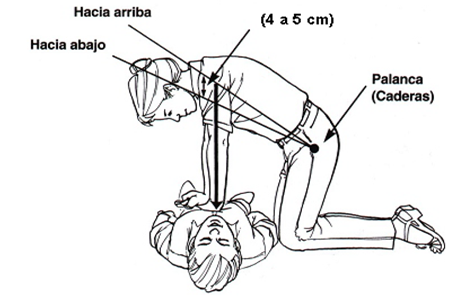 Reanimación cardiopulmonar básica (RCP)