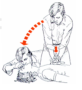 Reanimación cardiopulmonar básica (RCP)