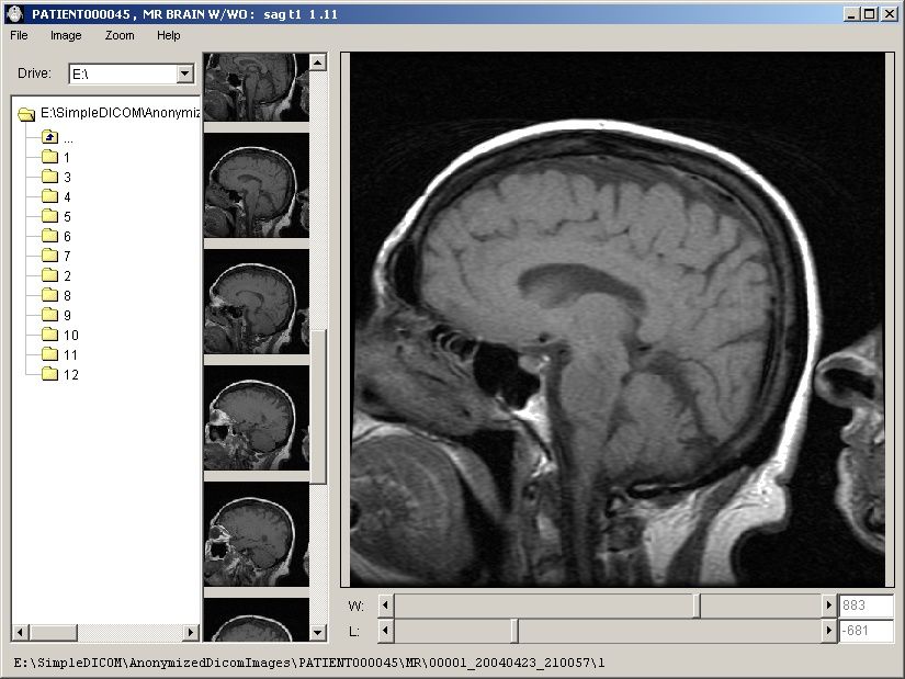 DICOM (comunicação com imagens digitais em medicina)