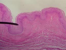 HISTOLOGIA DE SISTEMA REPRODUCTOR FEMENINO