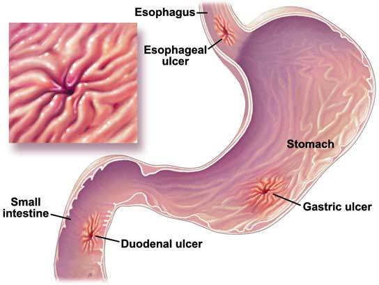 _Classification of the different diseases and disorders of the digestive system_