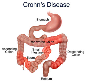 _Classification of the different diseases and disorders of the digestive system_