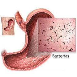 _Classification of the different diseases and disorders of the digestive system_