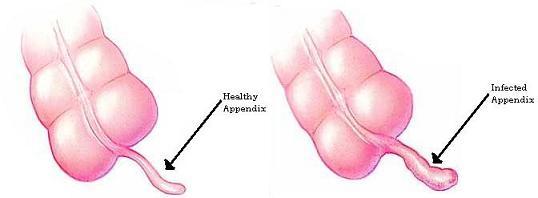 _Classification of the different diseases and disorders of the digestive system_