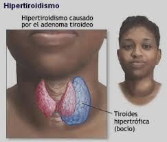 DEFICIENCIA DE GH EN LOS ADULTOS