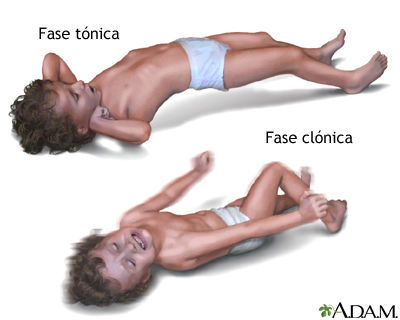 ERRORES INNATOS DEL METABOLISMO: Emergencia metabolica