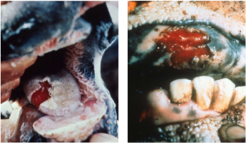 Pathology of the Alimentary Tract 1 (Oral Cavity &amp; Oesophagus)