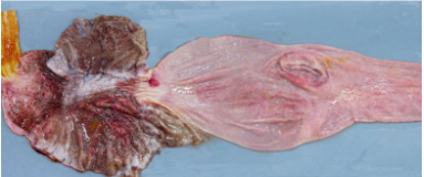 Pathology of the Alimentary Tract 1 (Oral Cavity &amp; Oesophagus)