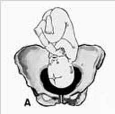 PELVIS OSEA NORMAL. PRESENTACION ACTITUD Y SITUACION FETALES. EVALUACION FETAL ANTEPARTO.
