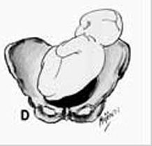 PELVIS OSEA NORMAL. PRESENTACION ACTITUD Y SITUACION FETALES. EVALUACION FETAL ANTEPARTO.