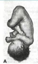 PELVIS OSEA NORMAL. PRESENTACION ACTITUD Y SITUACION FETALES. EVALUACION FETAL ANTEPARTO.