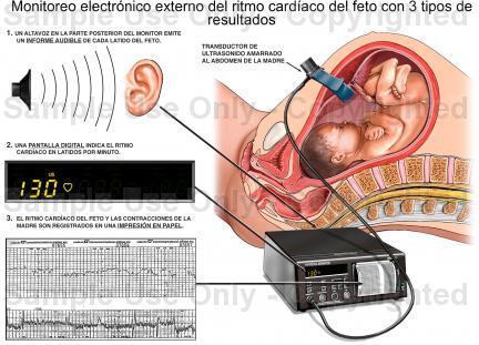 PELVIS OSEA NORMAL. PRESENTACION ACTITUD Y SITUACION FETALES. EVALUACION FETAL ANTEPARTO.