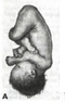 Pelvis osea normal. Presentación, actitud y situación fetal. Evaluación anteparto