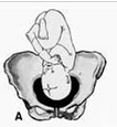 Pelvis osea normal. Presentación, actitud y situación fetal. Evaluación anteparto
