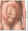 Pelvis osea normal. Presentación, actitud y situación fetal. Evaluación anteparto