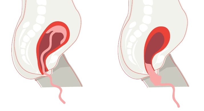 Mecanismo de parto: Conducta ante el parto normal