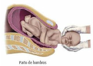 Mecanismo de parto: Conducta ante el parto normal