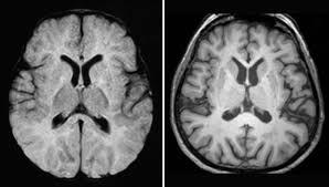 Desarrollo de la psicofisiología y la psicología clinica