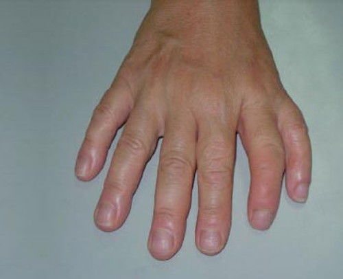 psicopatologia infantil