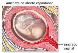 SESIÓN 16. Embarazo en los extremos de la vida. Aborto. Embarazo ectópico.