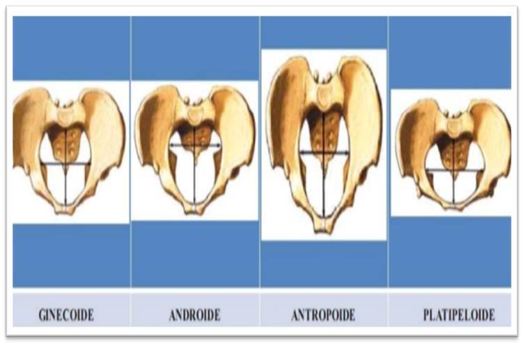 Alteraciones de la actividad uterina durante el trabajo de parto